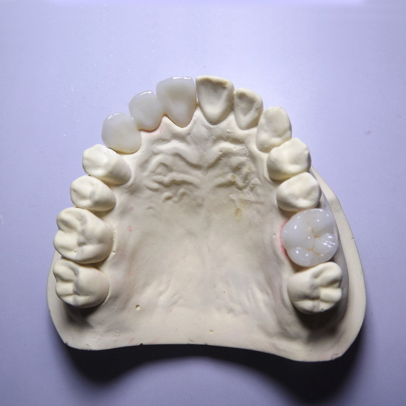 Layered Zirconia