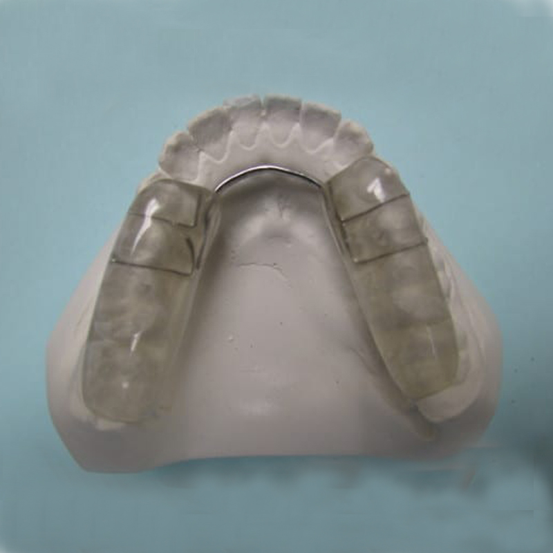 The role of occlusal splints