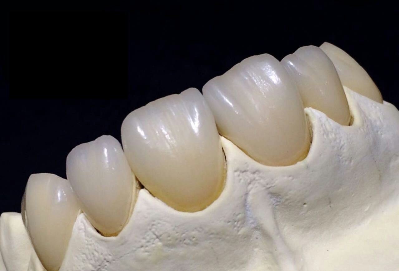 Full Zirconia Crown China dental lab