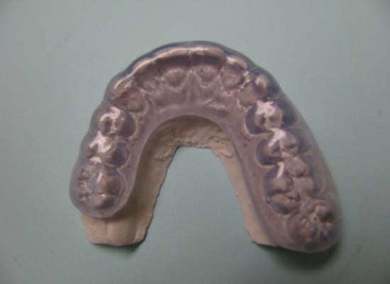 Occlusal Brace